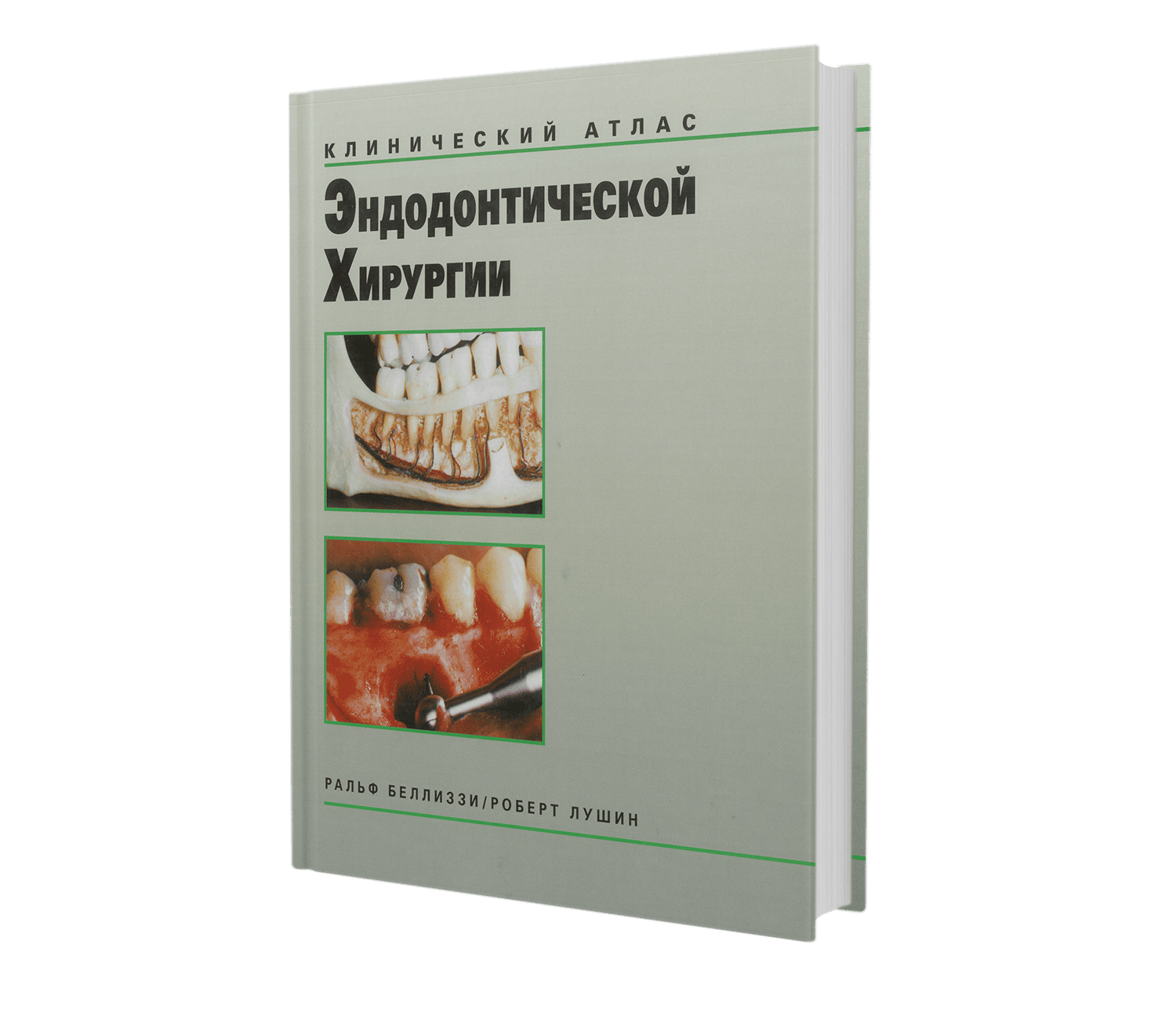 Клинический алтас эндодонтической хирургии