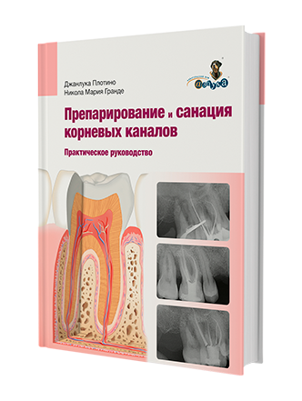 Практическое руководство. Препарирование и санация  корневых каналов