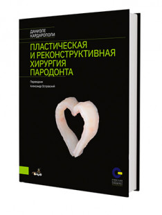 Пластическая и реконструктивная хирургия пародонта