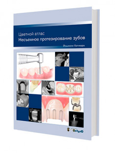 Несъемное протезирование зубов. Цветной атлас.