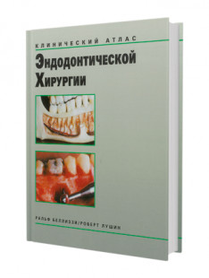 Клинический алтас эндодонтической хирургии