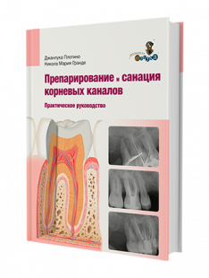 Практическое руководство. Препарирование и санация  корневых каналов