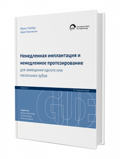 Немедленная имплантация и немедленное протезирование