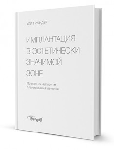 Имплантация в эстетически значимой зоне. Поэтапный алгоритм планирования лечения