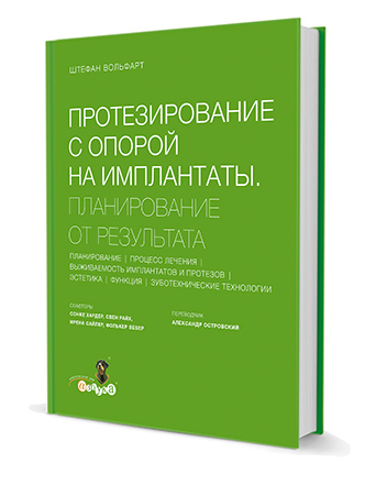 Протезирование с опорой на имплантаты. Планирование от результата.