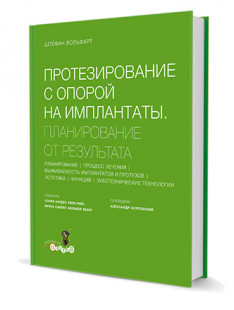 Протезирование с опорой на имплантаты. Планирование от результата.