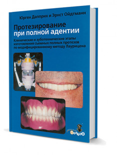 Протезирование при полной адентии. Клинические и зуботехнические этапы изготовления съемных полных протезов по модифицированному методу Лаурицена