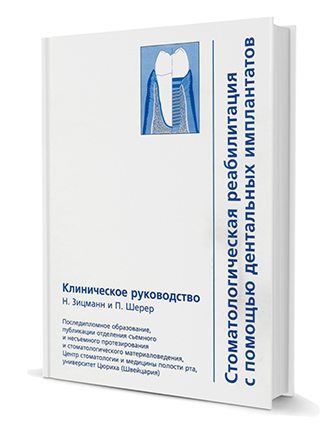 Стоматологическая реабилитация с помощью дентальных имплантатов