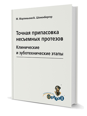 Точная припасовка несъемных протезов. Клинические и зуботехнические этапы